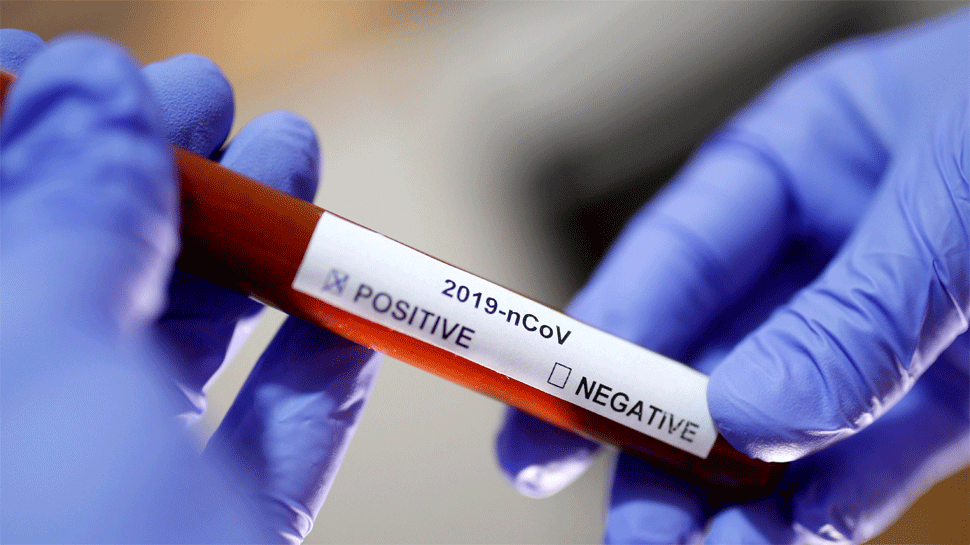 RECORD. 42.394 de români infectați cu coronavirus de la începutul epidemiei