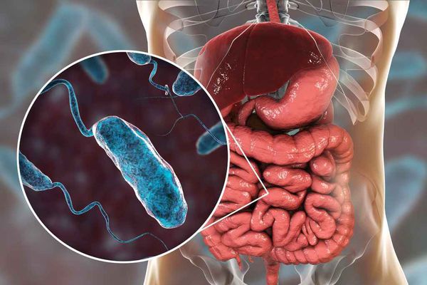 Vibrionul holeric: Tulpina izolată nu provoacă boală omului, transmite Ministerul Sănătății