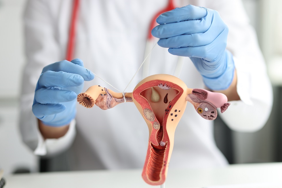 <strong>Tot ce trebuie să știi despre legarea trompelor uterine</strong>